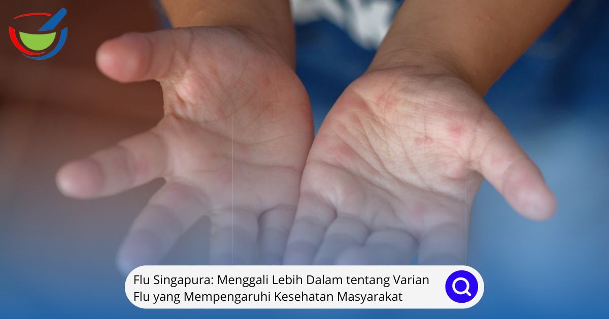 Flu Singapura Menggali Lebih Dalam tentang Varian Flu