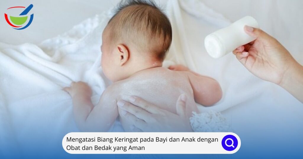 Mengatasi Biang Keringat pada Bayi dan Anak dengan Obat dan Bedak yang Aman